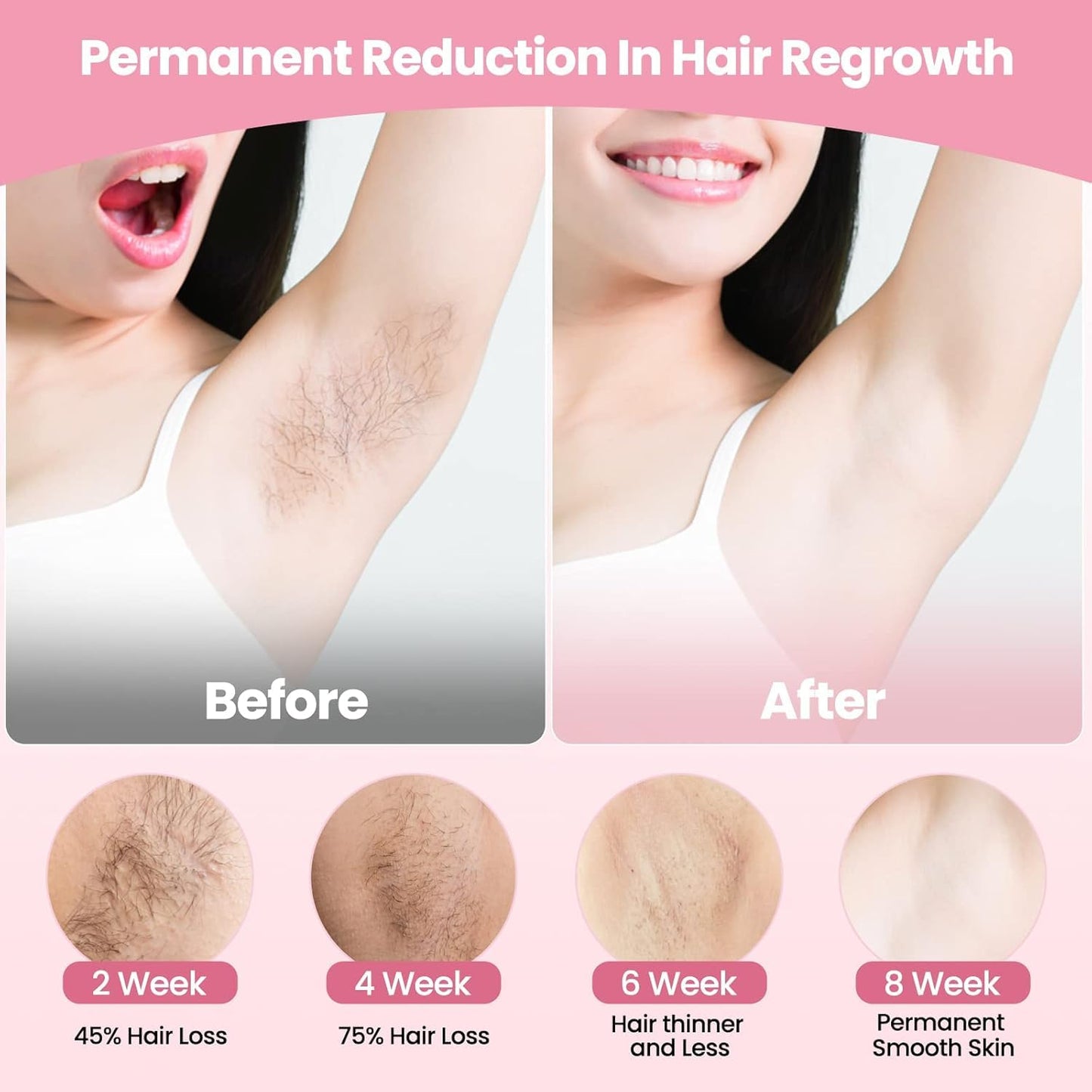 Professional Laser Epilator IPL Hair Removal Body Bikini Leg